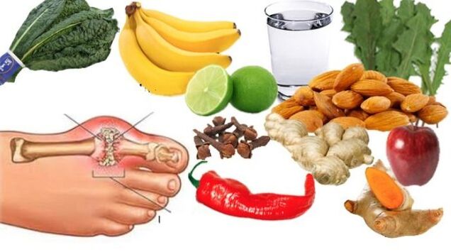 Bệnh nhân gút được chỉ định chế độ ăn nhẹ nhàng
